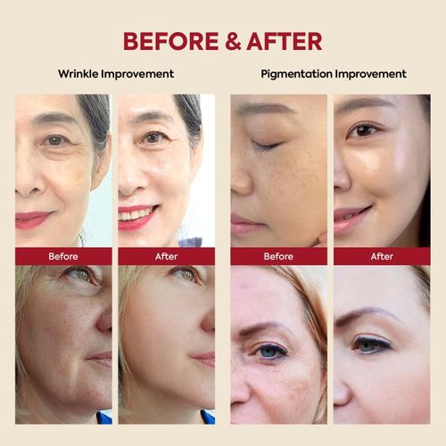 KSECRET – SEOUL 1988 Crème au Rétinol et aux Enzymes de Riz Cream : Retinal Liposome